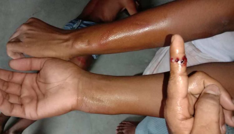 Rohingya accuse Bangladesh officers of abuse over hunger strike | Bangladesh