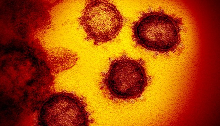 Coronavirus can survive for 28 days on some surfaces: Study | Australia