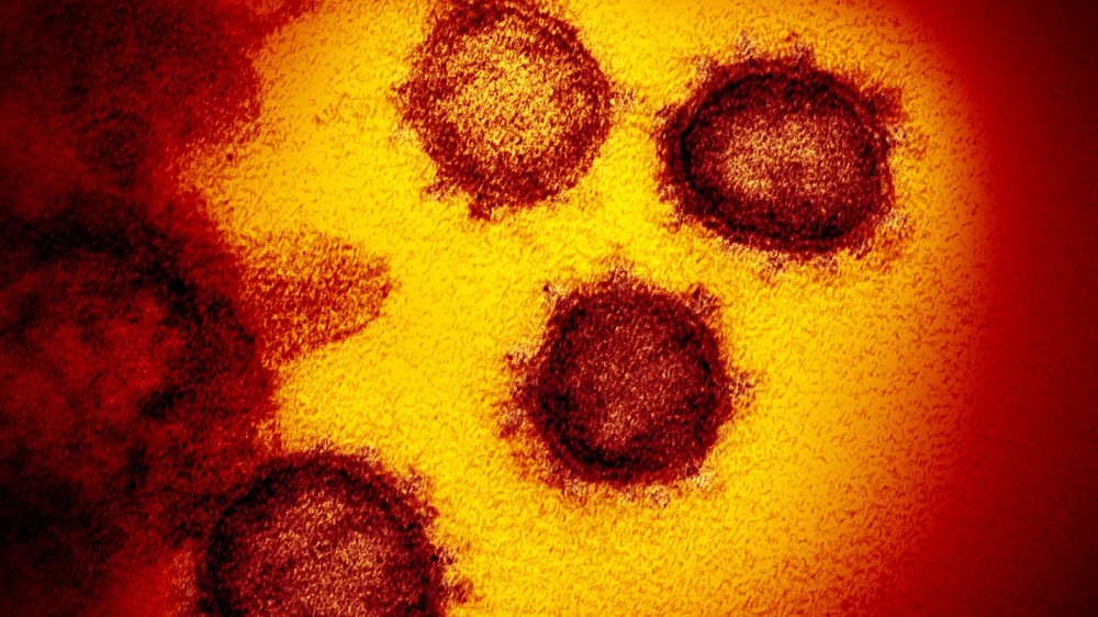Coronavirus can survive for 28 days on some surfaces: Study | Australia