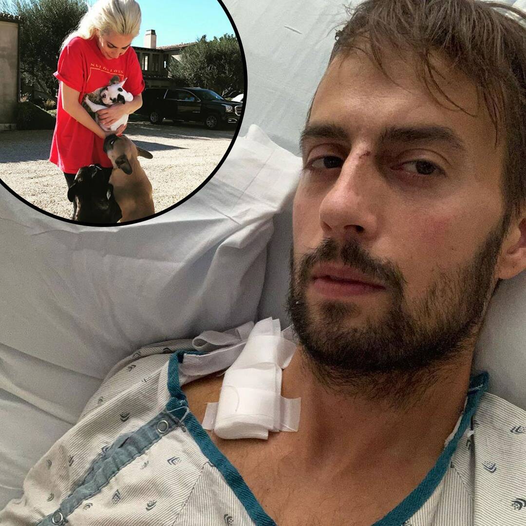 Lady Gaga’s Dog Walker Opens Up About Being Shot And More In His First Statement Since The Life-Threatening Incident!