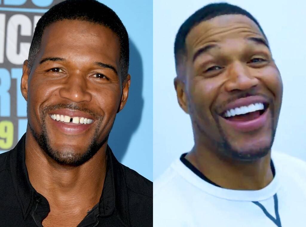 Michael Strahan Gets Rid Of His Iconic Tooth Gap - Check Out The Video!